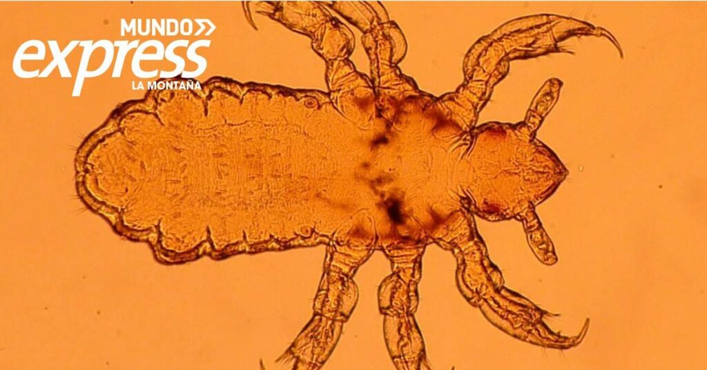 Brote de piojos en Hidalgo tiene en alerta