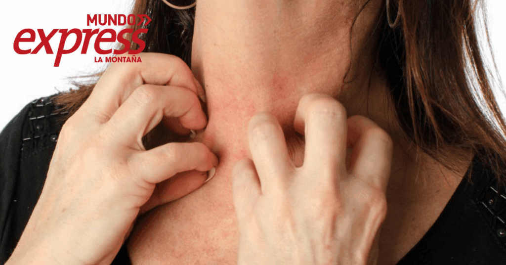 Reportan intoxicaciones en Mineral del Chico